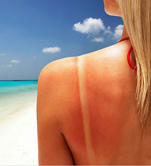 bronzlasmak-bagimlilik-haline-geldi_24062010165337